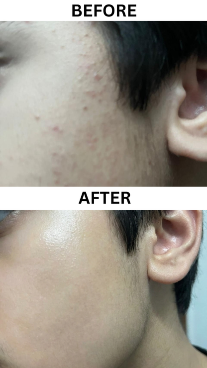 Kojic Acid Skin Lightening Soap