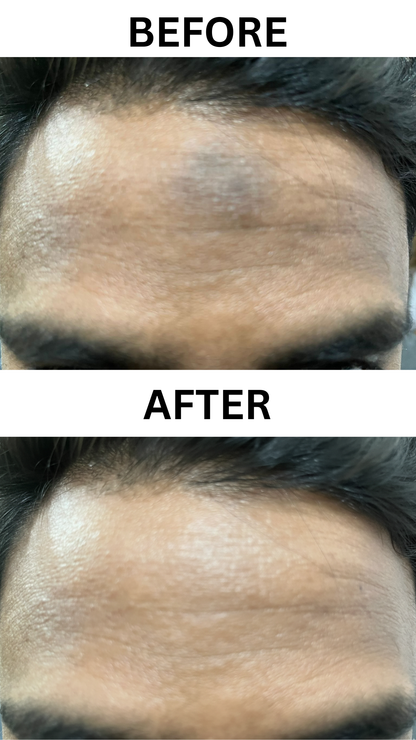 Kojic Acid Skin Lightening Soap